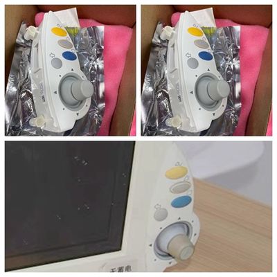 Philip MP60 MP40 MP50 Bộ mã hóa màn hình bệnh nhân Silicon phần gốc
